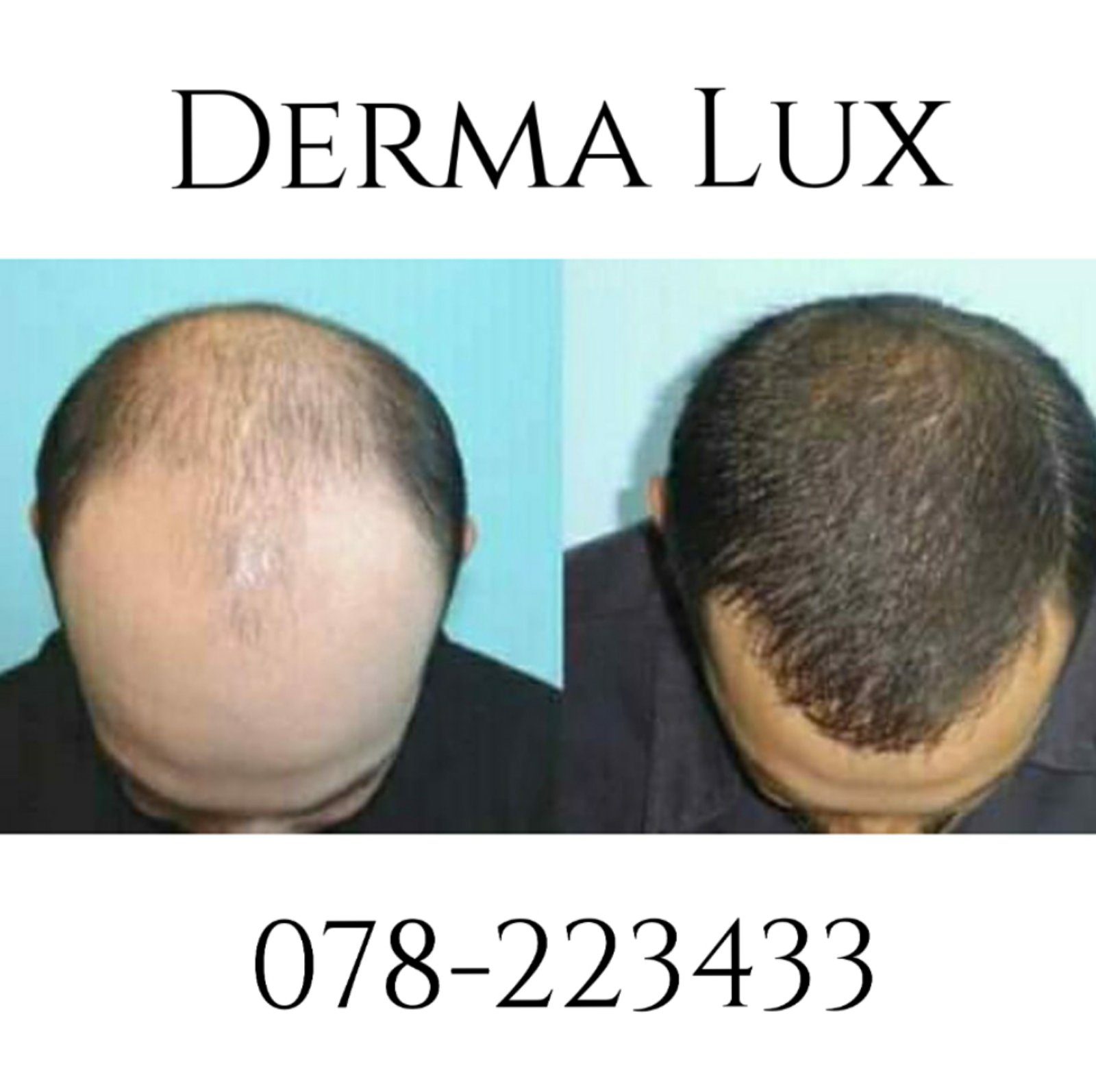 Derma Lux, Beauty & skincare, Skopje