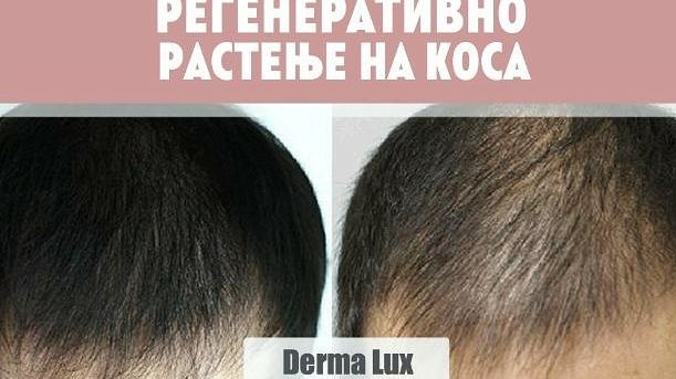 Derma Lux, Beauty & skincare, Skopje